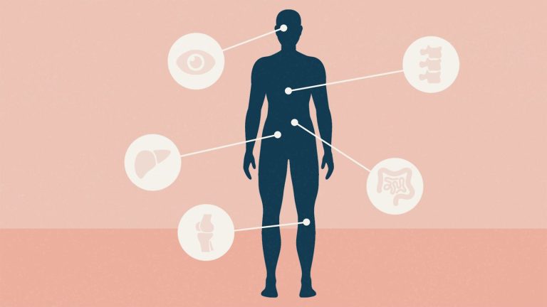 ulcerative-colitis-complications-how-to-avoid-1440x810