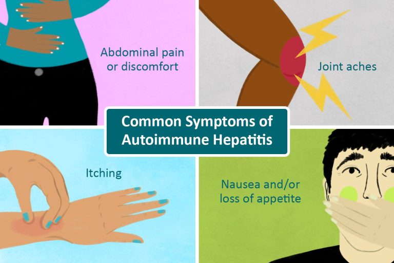 VWH_Illustration_Common-Symptoms-of-Autoimmune-Hepatitis_Illustrator_Danie-Drankwalter_Final-beb28755b4ed43659728796c5beb80b7