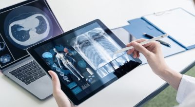 Medical Imaging Informatics Market Trends, Innovations and Segment Insights