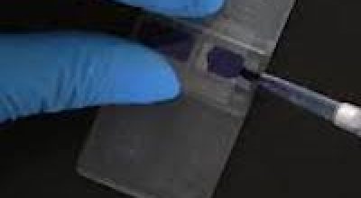Cell Counting Market Trends, Drivers and Growth Opportunities